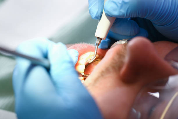Best Knocked-Out Tooth Emergency  in Bradford, PA